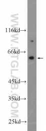 25350-1-AP - NADPH oxidase 5 / NOX5