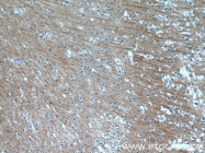 25517-1-AP - Neuropeptide B
