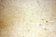 18084-1-AP - Neurotrophin 3 / NTF3