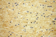 18084-1-AP - Neurotrophin 3 / NTF3