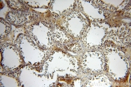 12297-1-AP - Neurotrophin 4 / NTF4