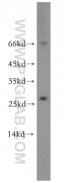 12297-1-AP - Neurotrophin 4 / NTF4