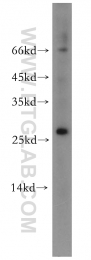 12297-1-AP - Neurotrophin 4 / NTF4