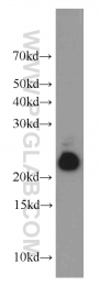 17508-1-AP - NUDT10 / APS2 / DIPP3A