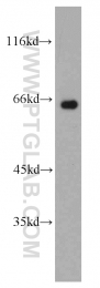 10111-1-AP - Numb-like protein / NUMBL
