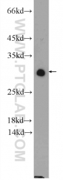 25381-1-AP - NUP62CL
