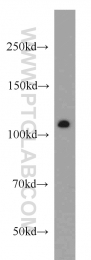 12329-1-AP - NUP98 / ADAR2
