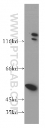 14632-1-AP - DDX6