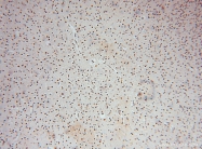16427-1-AP - USP52 / PAN2