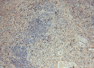 16427-1-AP - USP52 / PAN2