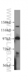 16427-1-AP - USP52 / PAN2