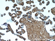 22522-1-AP - PGD synthetase / PGDS