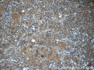 22522-1-AP - PGD synthetase / PGDS