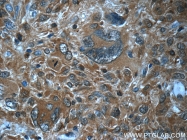 22522-1-AP - PGD synthetase / PGDS