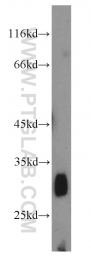 22522-1-AP - PGD synthetase / PGDS
