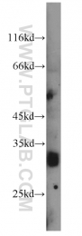 22522-1-AP - PGD synthetase / PGDS