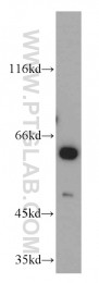 22456-1-AP - PKLR