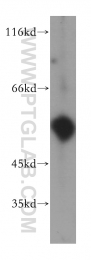 17968-1-AP - uPA / PLAU