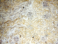 18003-1-AP - DNA polymerase beta