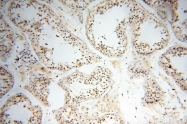 18003-1-AP - DNA polymerase beta