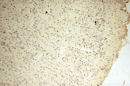18003-1-AP - DNA polymerase beta