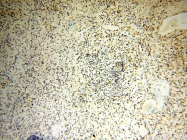 18003-1-AP - DNA polymerase beta