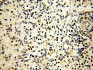 18003-1-AP - DNA polymerase beta