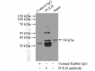 18003-1-AP - DNA polymerase beta