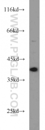 18003-1-AP - DNA polymerase beta