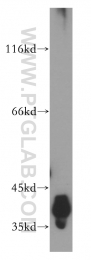 18003-1-AP - DNA polymerase beta