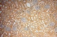 14873-1-AP - DNA polymerase mu