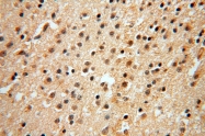 14873-1-AP - DNA polymerase mu