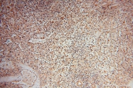 14873-1-AP - DNA polymerase mu