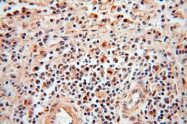 14873-1-AP - DNA polymerase mu