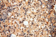 14873-1-AP - DNA polymerase mu