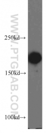 20595-1-AP - POLR1A