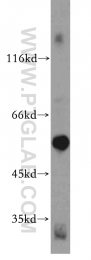 19653-1-AP - PPP3CC / CALNA3