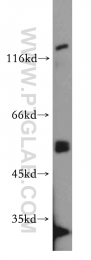 19653-1-AP - PPP3CC / CALNA3
