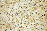 13210-1-AP - PPP3R1 / Calcineurin B