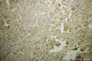 14005-1-AP - PPP3R2 / CBLP