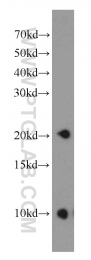 14005-1-AP - PPP3R2 / CBLP