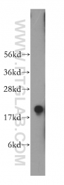 14005-1-AP - PPP3R2 / CBLP