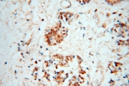 15395-1-AP - PRMT6 / HRMT1L6