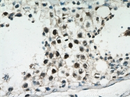 15395-1-AP - PRMT6 / HRMT1L6