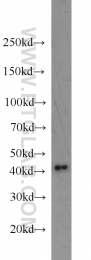15395-1-AP - PRMT6 / HRMT1L6