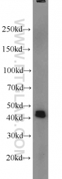 15395-1-AP - PRMT6 / HRMT1L6