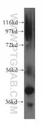 15395-1-AP - PRMT6 / HRMT1L6