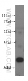 15395-1-AP - PRMT6 / HRMT1L6