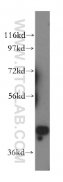 15395-1-AP - PRMT6 / HRMT1L6