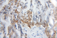 11391-1-AP - CD201 / EPCR